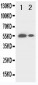 Anti-Beta Glucuronidase(Gusb) Antibody
